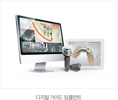 365서울진심치과 디지털 가이드 임플란트 장비