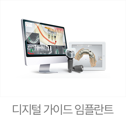 365서울진심치과 디지털 가이드 임플란트 장비