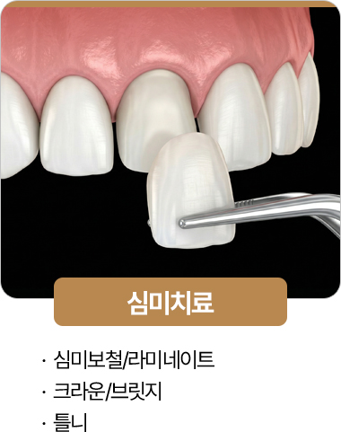 365서울진심치과 심미치료