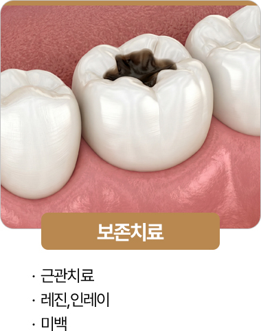 365서울진심치과 보존치료